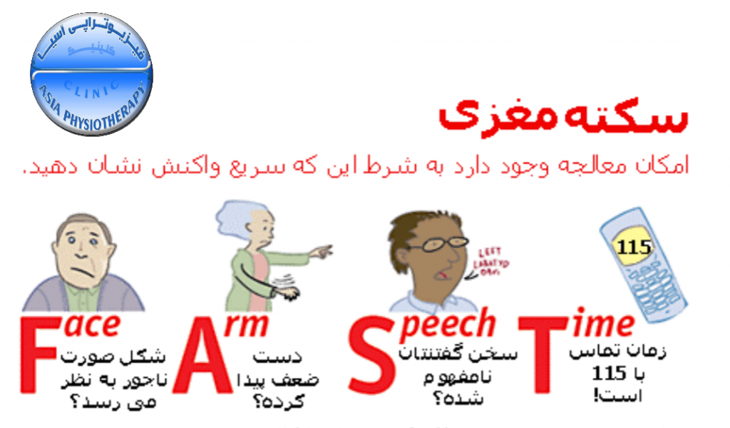 تشخیص و اقدام اورإانسی در سکته مغزی