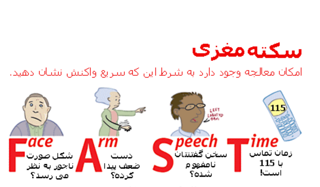 FAST تشخیص 4مرحله ای وقوع و اقدام در سکته مغزی